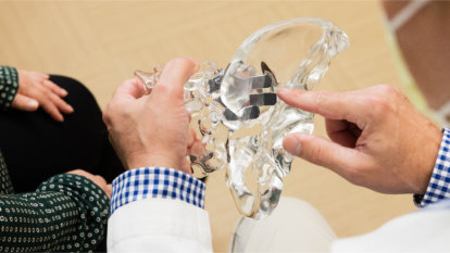 Close up of Dr. Elmes holding a plastic model hip demonstrating the implants placed to stabilize a SI joint.